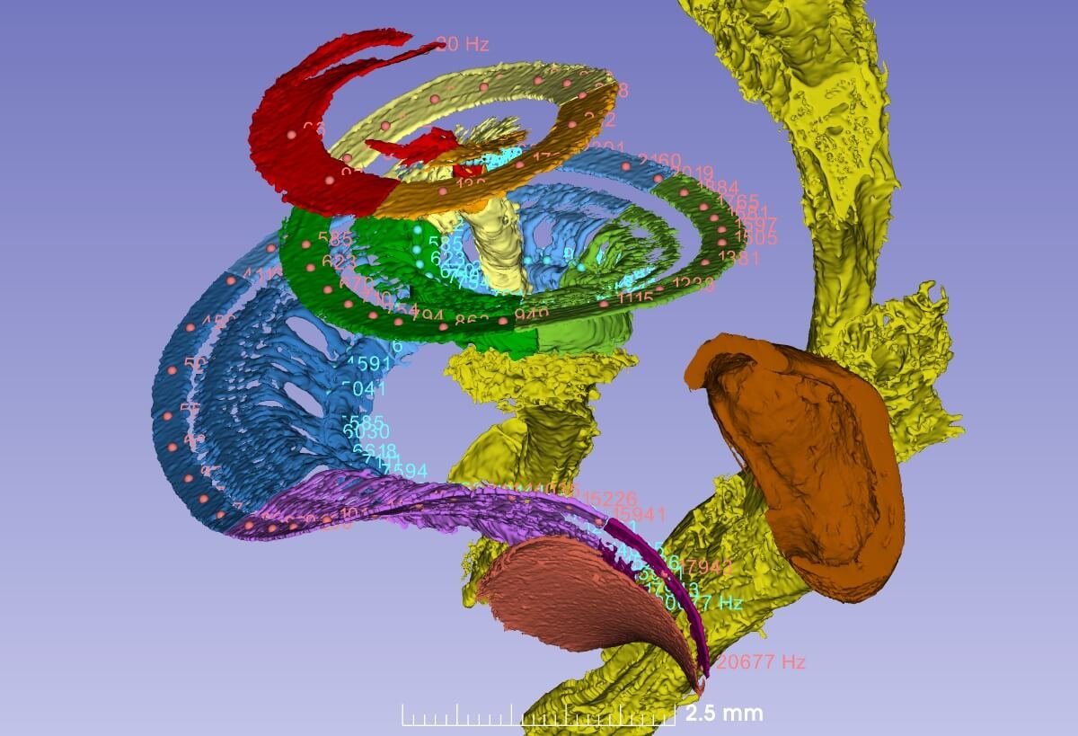 Imagen de la impresión 3D de la cóclea